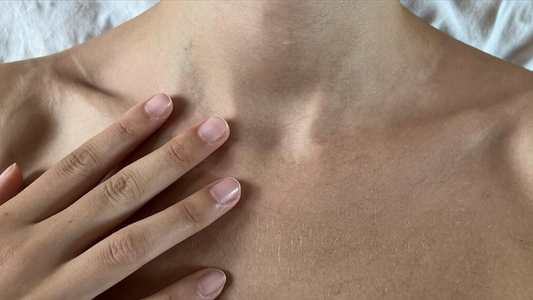 Dark skin folds and insulin resistance